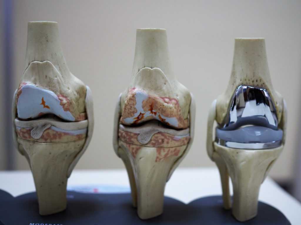 struttura dell'articolazione del ginocchio 